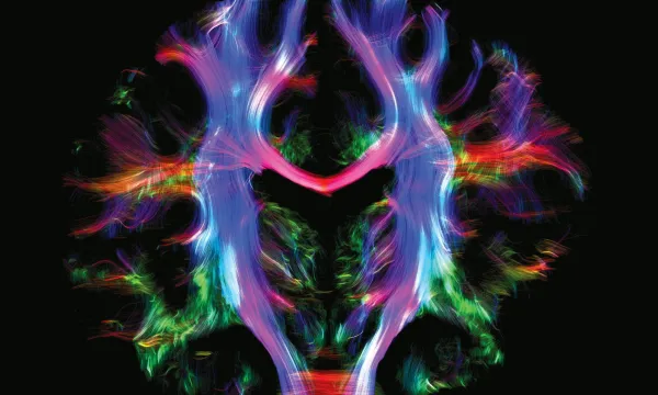 A colourful image of a brain scan 