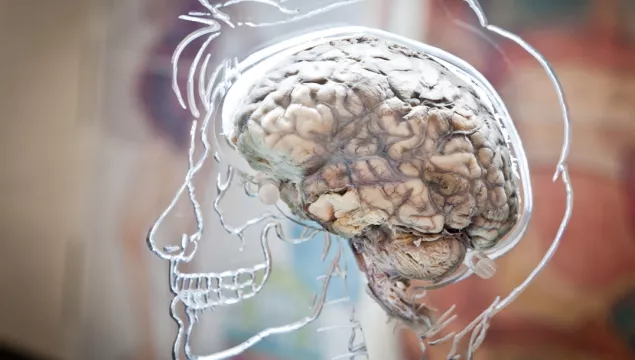 An exhibit of a human brain inside of an illustrative plexiglass